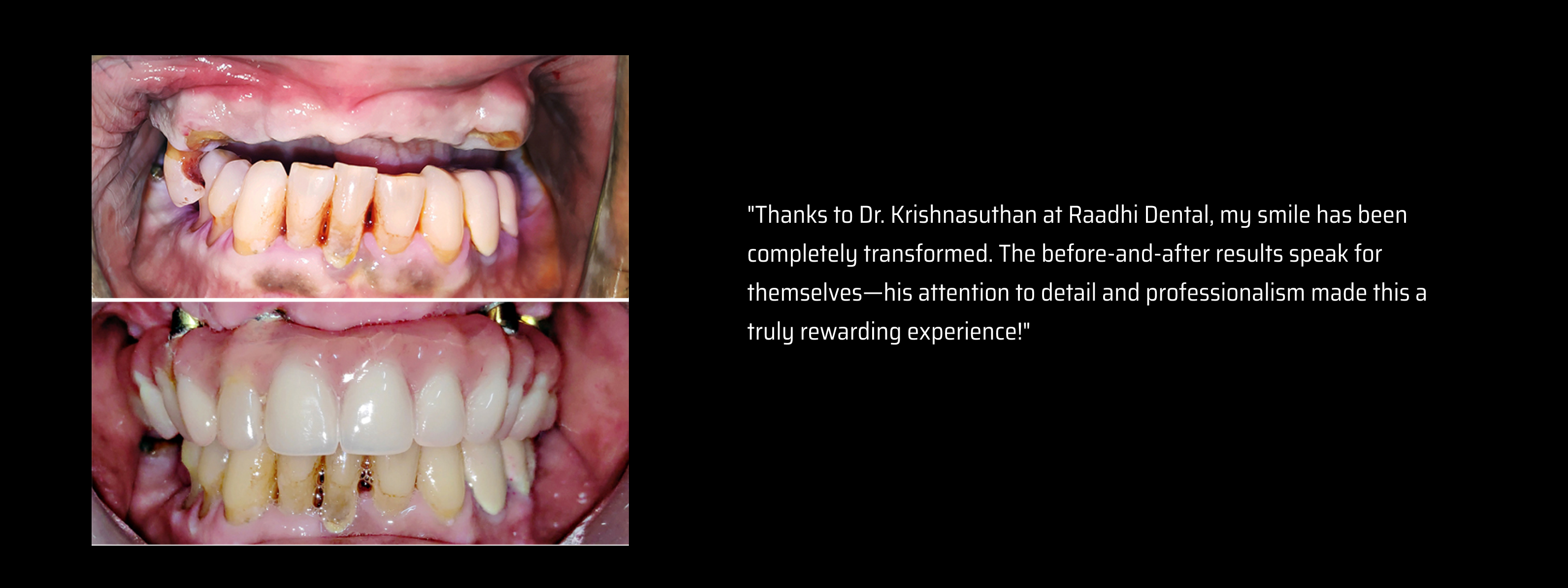 First slide