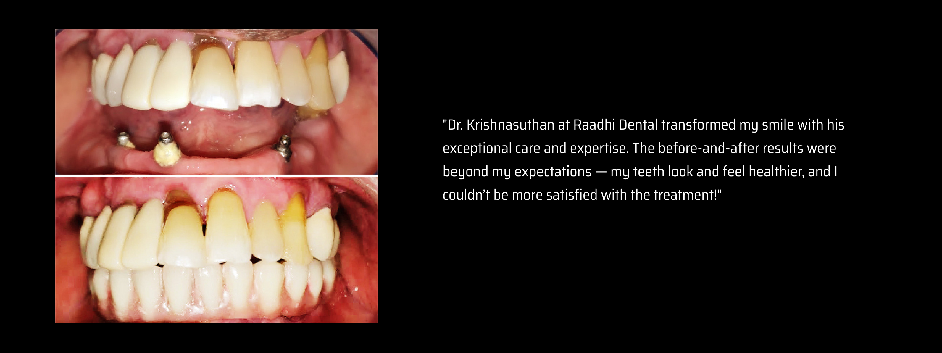 Second slide