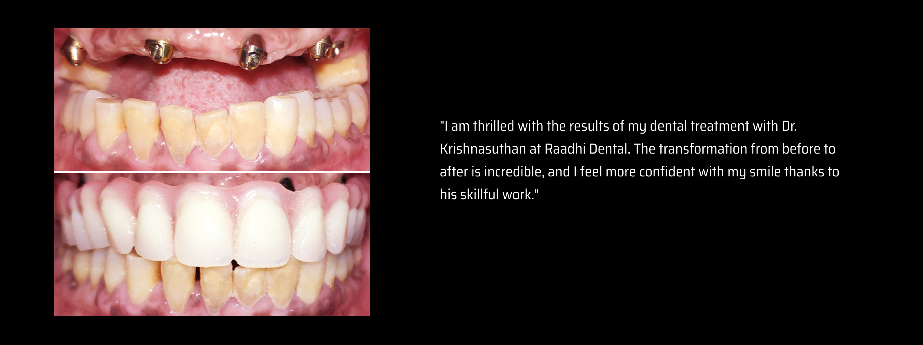 Third slide