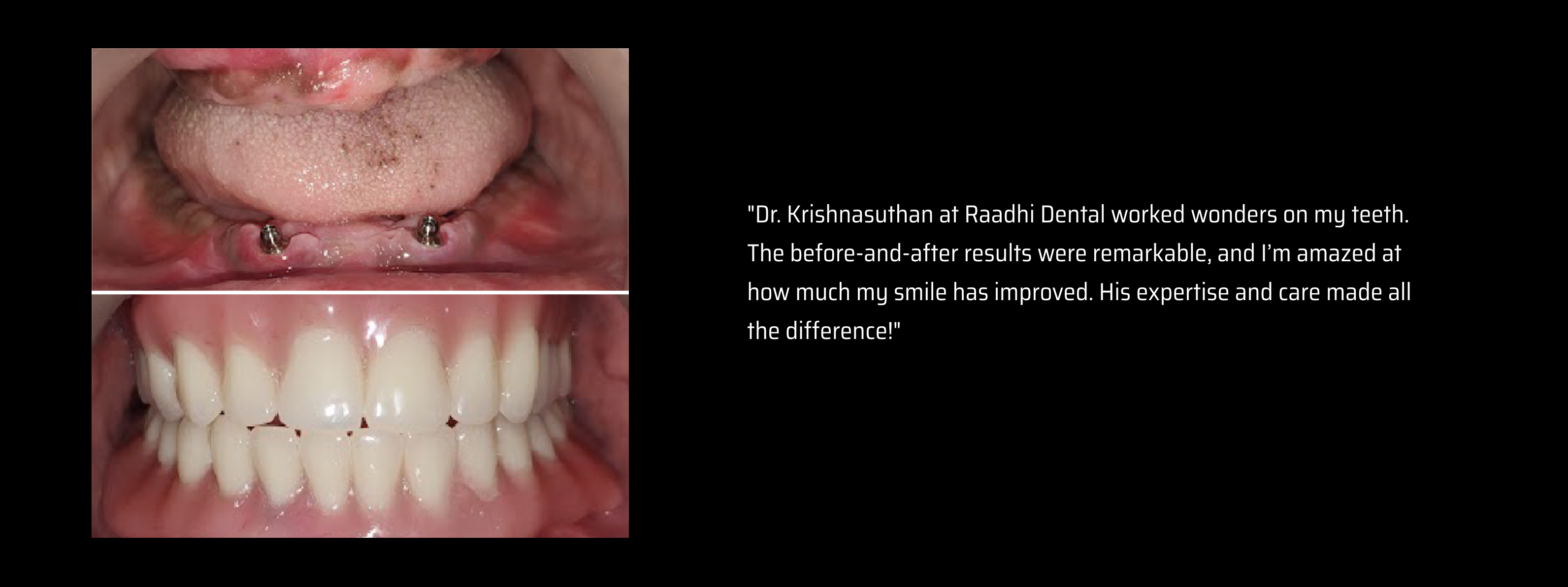 Third slide